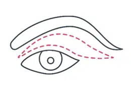 eyelids top cut new