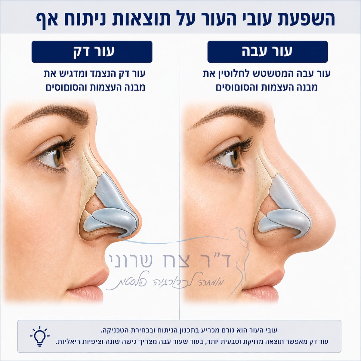 השפעת עובי העור על תוצאות ניתוח אף, עור עבה מול עור דק