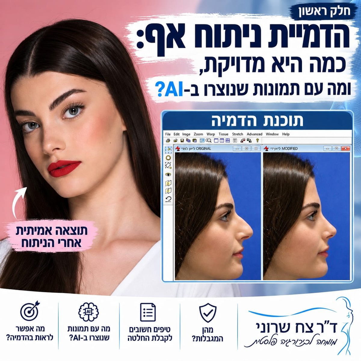 הדמיית ניתוח אף: כמה היא מדויקת, חלק ראשון, ד״ר צח שרוני