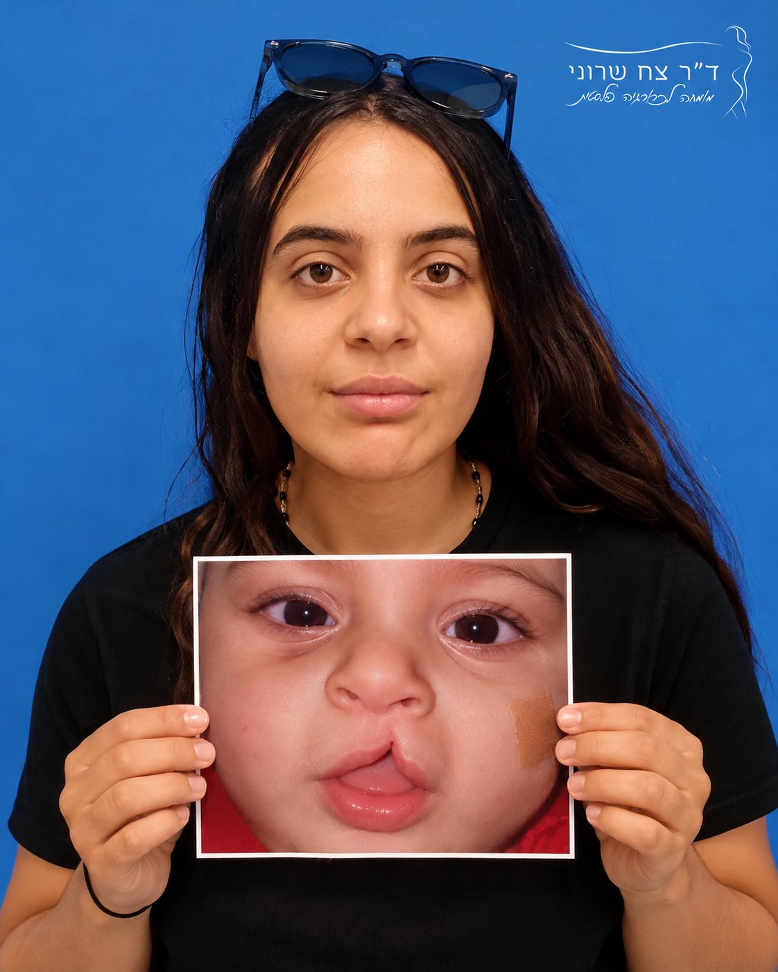 חדש ברמב"ם: ניתוח אף בשיטה הפתוחה ובפייאזו למטופלי שפה שסועה, ד״ר צח שרוני
