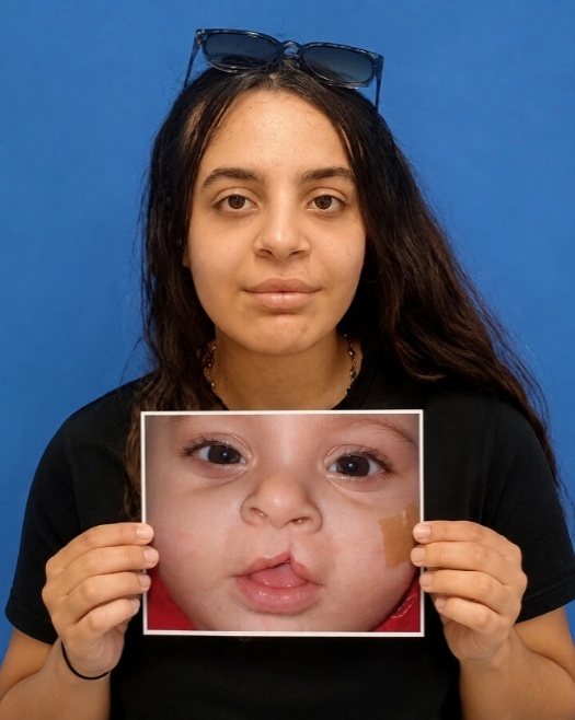 מטופלת בת 17 לאחר ניתוחי שפה שסועה, מחזיקה תמונה שלה כתינוקת